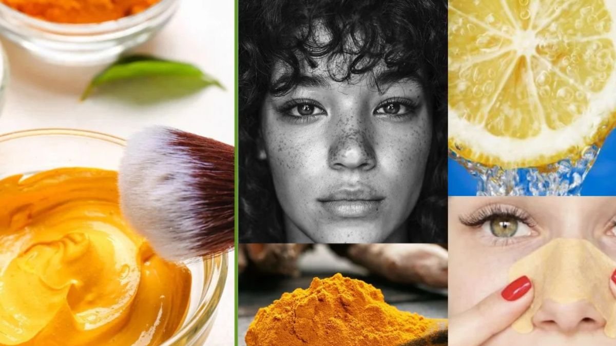 மூக்கில் பிளாக் ஹெட்ஸ் நீங்குவதற்கான இயற்கை வழிகள் | Natural Blackhead Removal Tips in Tamil