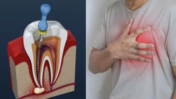 Root Canal Heart Attack connection explained by doctors - பல் தொற்று மற்றும் இதய நோய்க்கு உள்ள தொடர்பு : நிபுணர்கள் விளக்கம்!
