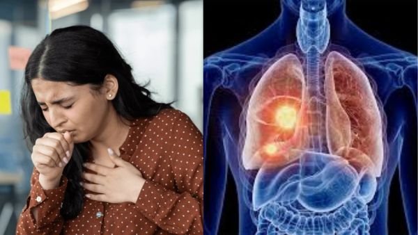 தொடர் இருமல் (Persistent Cough) - அலட்சியம் செய்யாதீங்க, இது Lung Cancer போன்ற ஆபத்தான நோயின் அறிகுறி ஆகலாம்!
