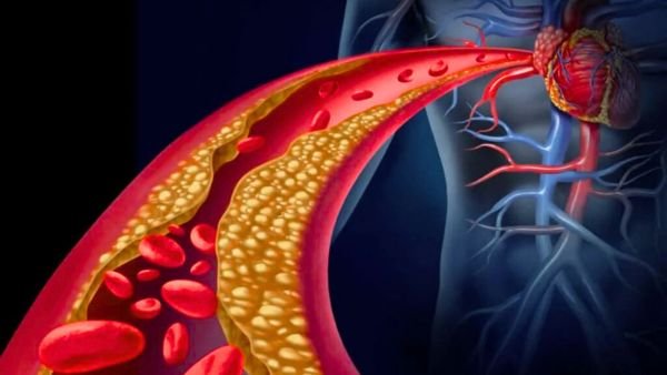 Cholesterol குறைய இயற்கை வழிகள் - Nutritionist சொல்லும் 3 Best Tips!